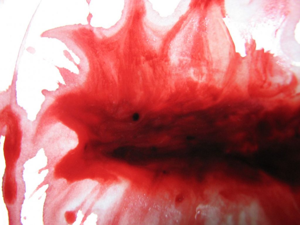 Dream Meaning of Menstrution Bleeding