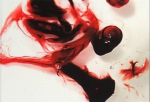 Dream Meaning of Menstrution Blood